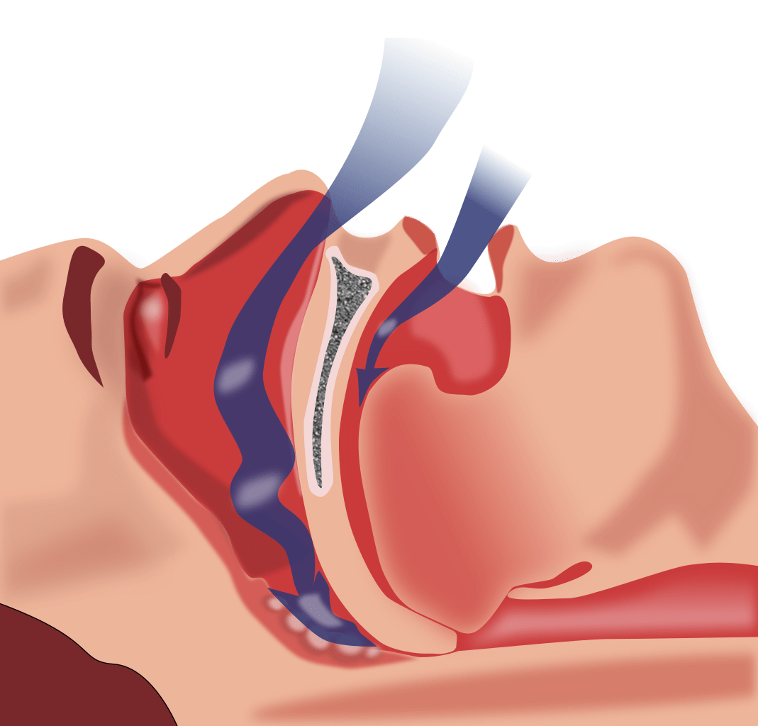 apnea anatomy